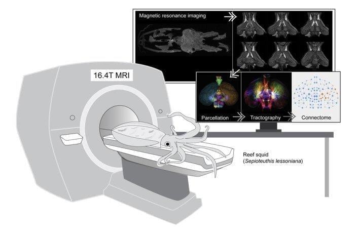 squid-mri.jpg