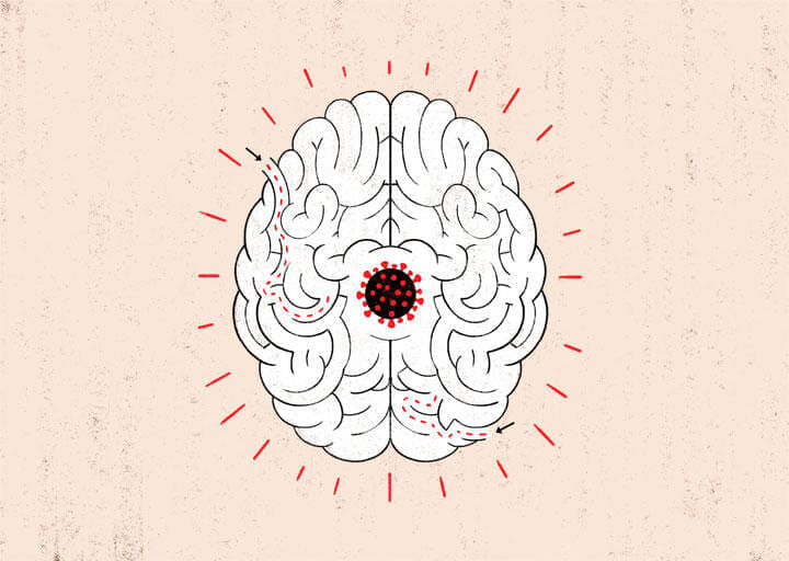 意識障害 感情の希薄化 精神疾患 コロナが 脳 にもたらす後遺症の深刻度 ニューズウィーク日本版 オフィシャルサイト