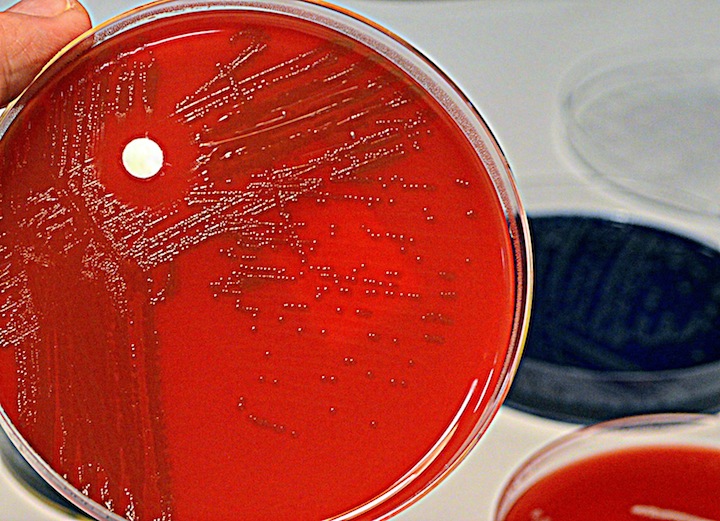 どの抗生物質も効かない スーパーバグ が世界に蔓延 豪科学者が警告 ニューズウィーク日本版 オフィシャルサイト